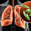 Prvi smrtni slučaj u epidemiji opake bolesti: U milionskom gradu izbila opaka zaraza, svi gledaju na krovove zgrada - tu je…
