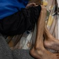 Alarmantno! Glad i bolesti se šire u Sudanu: 25 miliona ljudi ugroženo zbog nedostatka hrane