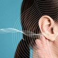 Zujanje u ušima povezano sa oštećenjem nerva i promenama u moždanom stablu