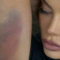Celo telo u podlivima: Milica Pavlović se povredila na snimanju spota