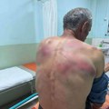 Jeziva ispovest pretučenog Srbina kod Zubinog Potoka: "Zastrašivali su mi sina, ženu su mi maltretirali"