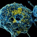 Potvrđena zaraza virusom MERS u UAE: Opakiji rođak korone, smrtnost mu je 34 odsto