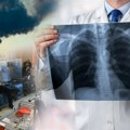 Alarmantni podaci o oboljevanju od raka pluća, najveći krivac zagađenje vazduha: „Na udaru nepušači, dobiju dijagnozu, a…