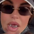 Užas! Dijana Dilajn doživela novu strašnu povredu, slomila vilicu, izvadili joj 8 zuba! Sad se oglasila