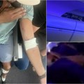 Prvi snimak propadanja aviona: Ljudi se drže za glave, vrište, povređeno najmanje 50 ljudi (foto/video)