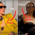 Ana Nikolić u tajnosti kod plastičara! Pevačica na remontu - dala 5.000 € za zamenu silikona i podizanje grudi: "Deformisale…