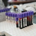Institut: Rezerve smanjene, apel građanima da doniraju krv