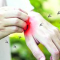 Dobro obratite pažnju na ove simptome! Zaraženi komarci otkriveni su u tri grada u Srbiji, dve osobe imaju virus Zapadnog…