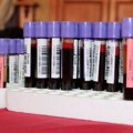 Poziv dobrovoljnim davaocima krvi: Akcija ck Ćuprija