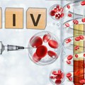 Oglasilo se ministarstvo: Broj HIV infekcija u Rusiji prepolovljen u poslednjih 10 godina