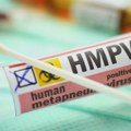 HMPV: Koji su simptomi i komplikacije infekcije koja liči na prehladu