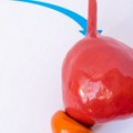 Kod uvećane prostate lekovi su privremeno rešenje problema sa mokrenjem: laserska hirurgija je vodeća metoda za lečenje