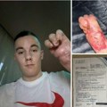 Veljko (23) ostao bez funkcije ruke nakon nesreće na njivi: za novu operaciju potrebno 5.000 evra