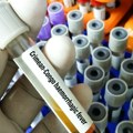 Krimsko-kongoanska groznica odnela jedan život u Grčkoj: Sad obolela doktorka koja je lečila nesrećnog čoveka?