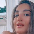 Anđela Đuričić otišla na remont: Kod plastičnog hirurga odradila čak 4 korekcije - ovo su detalji, rešila da izgleda skroz…