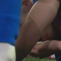 Jezive scene u Ligi šampiona, fudbaleru Barselone krvarila glava