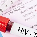 Stigma i strah i dalje problem: Više od 1.000 ljudi u Srbiji bez dijagnoze HIV-a