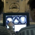 Srbija dobija Centar za multiplu sklerozu i srodne bolesti, prvi tog tipa u regionu