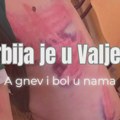 Zborovi Zrenjanina i danas, 15. avgusta pozivaju na protest “Srbija je u Valjevu, a gnev i bol u nama!” PROTEST, 15.8.2025…