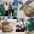 Muškarcu iz mokraćne bešike izvadili kamen težak 3,1 kilogram: Grumen veličine nojevog jajeta šokirao je i doktore