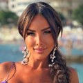 "Moja najružnija fotka" Evo kako je Aleksandra Subotić izgledala pre operacija, ni rođena majka je ne bi prepoznala!