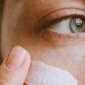 Nove tehnologije zatežu kožu bez skalpela: Ko je kandidat za ovakve tretmane?