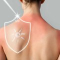 Spf 30 ili 50: Šta broj na kremi za sunčanje zaista govori i gde ljudi najčešće greše