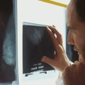 Lekari objašnjavaju zašto sve više ljudi mlađih od 50 godina obolevaju od raka