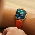 Zašto sve više korisnika bira pametne satove sa EKG funkcijom? Huawei je prvi doneo ovu opciju, evo kako radi