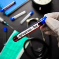 Šta je leptospiroza, zaraza čija je epidemija proglašena u Sarajevu? Ovo su simptomi bolesti