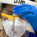 Opasna zaraza se širi, ima mrtvih! Alarmantno u Americi: Najveća epidemija od 1992. godine, ovo su najugroženije grupe