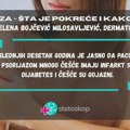 Psorijaza – šta je pokreće i kako se leči?