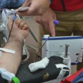 Institut za transfuziju krvi: Najmanje zalihe nulte negativne krvne grupe