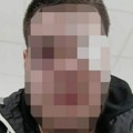 Ovo je pretučeni učenik srednje škole u Beogradu: Polomljena mu jagodična kost, završio u bolnici
