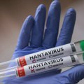SZO: Situacija sa hantavirusom nije uporediva sa pandemijom kovida