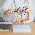 Broj obolelih od karcinoma debelog creva raste - doktor ukazao na faktore rizika