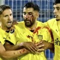 Fudbaler Penjarola nakon meča pogođen kamenicom u glavu