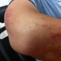 Nova epidemija na Pragu? Region pod udarom leptospiroze da li je Srbija ugrožena?