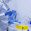 Ruski naučnici sa međunarodnim timom razvili novi lek protiv raka dojke