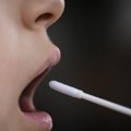 Koronavirus u Srbiji: Pacijenata sve više, simptomi blagi