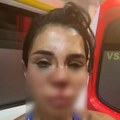 Brutalno pretučena influenserka Soraja