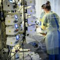 Dr Stjepanović: Od karcinoma pluća u Srbiji svaka dva sata premine jedna osoba