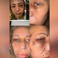 Prijateljica Darka Lazića brutalno pretučena, oglasila se pevačica o užasnom nasilju koje se desilo: "Reagujte dok još nije…