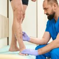 Proširene vene mogu da povećaju rizik od neizlečive bolesti FOTO