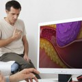 Svakog sata u Srbiji 5 ljudi umre od kardiovaskularnih bolesti: Svi su čuli za "loš" holesterol, ali malo ko zna da je jedan…
