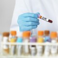 Jednostavan test krvi može da otkrije koliko ste „otrovani“ brzom hranom: Evo kako može da se sazna koliko je ima u telu