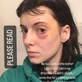 "Blic" saznaje: Uhapšen nasilnik koji je brutalno pretukao Ruskinju: Pijan joj naneo jezive povrede, pa pobegao!