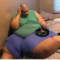 Imao je 408 kilograma i jeo bez prestanka: Rekli su da će uskoro umreti, a on danas izgleda neverovatno (foto)