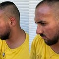 Prve slike brutalno pretučenog zadrugara: Jezive povrede po glavi, pomodreo skroz