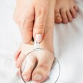 Debeli nokti na nogama nisu znak samo gljivica: Šta se krije iza ove promene i kada to postaje opasno